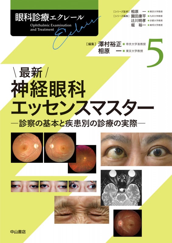 最新 神経眼科エッセンスマスター―診察の基本と疾患別の診療の実際 (5巻) (眼科診療エクレール)