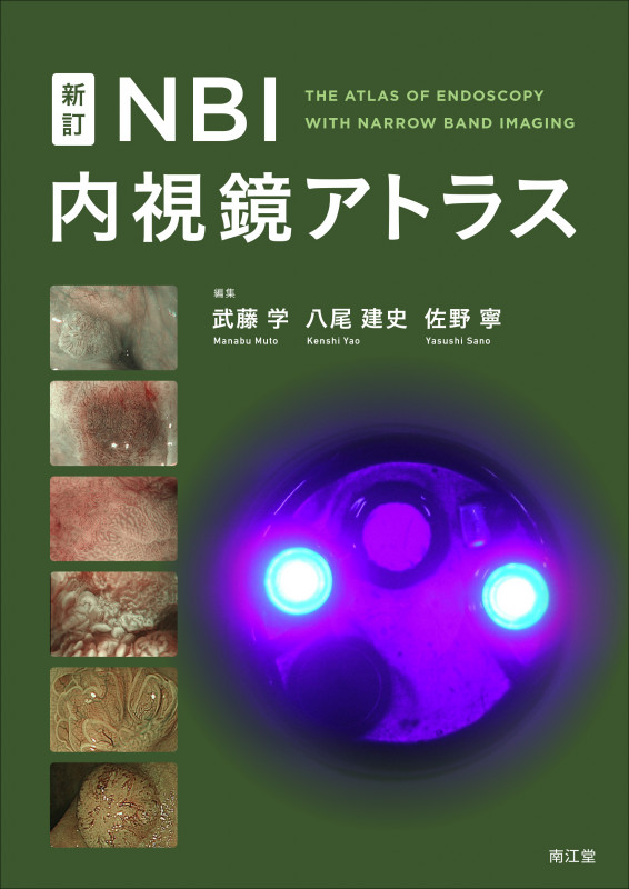 症例から学ぶ内視鏡医・内視鏡技師のための大腸腫瘍診断・治療