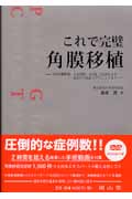 これで完璧角膜移植 全層角膜移植、上皮移植、DALK、DSAEKなど