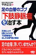 足の血管のコブ「下肢静脈瘤」を治す本 (ビタミン文庫)