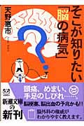 そこが知りたい「脳の病気」 (新潮文庫)の詳細を見る