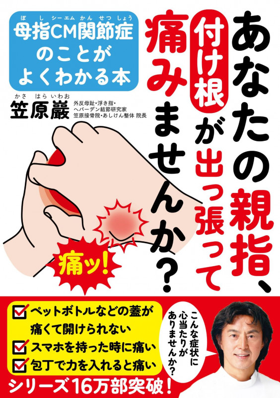 あなたの親指、付け根が出っ張って痛みませんか? 母指CM関節症のことがよくわかる本