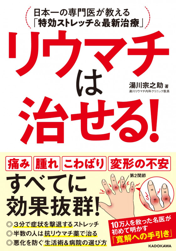 リウマチは治せる! 日本一の専門医が教える「特効ストレッチ&最新治療」の詳細を見る