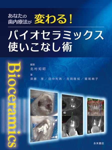 あなたの歯内療法が変わる! バイオセラミックス使いこなし術