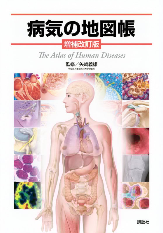 病気の地図帳 増補改訂版の詳細を見る