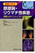 画像で診る膠原病・リウマチ性疾患 読影のポイントとコツ