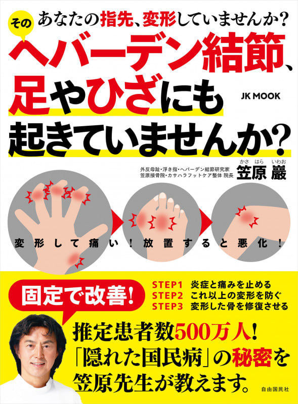 そのヘバーデン結節、足やひざにも起きていませんか? あなたの指先、変形していませんか? (JK MOOK)