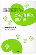 がん治療の前と後 納得できる治療を受けて、前向きに過ごすための手引き
