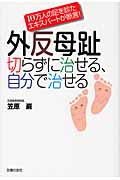外反母趾 切らずに治せる、自分で治せる 10万人の足を診たエキスパートが断言!