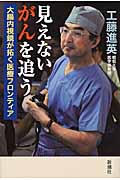 見えないがんを追う 大腸内視鏡が拓く医療フロンティア