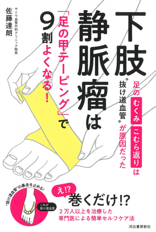下肢静脈瘤は「足の甲テーピング」で9割よくなる! 足のむくみ・こむら返りは“抜け道血管”が原因だった