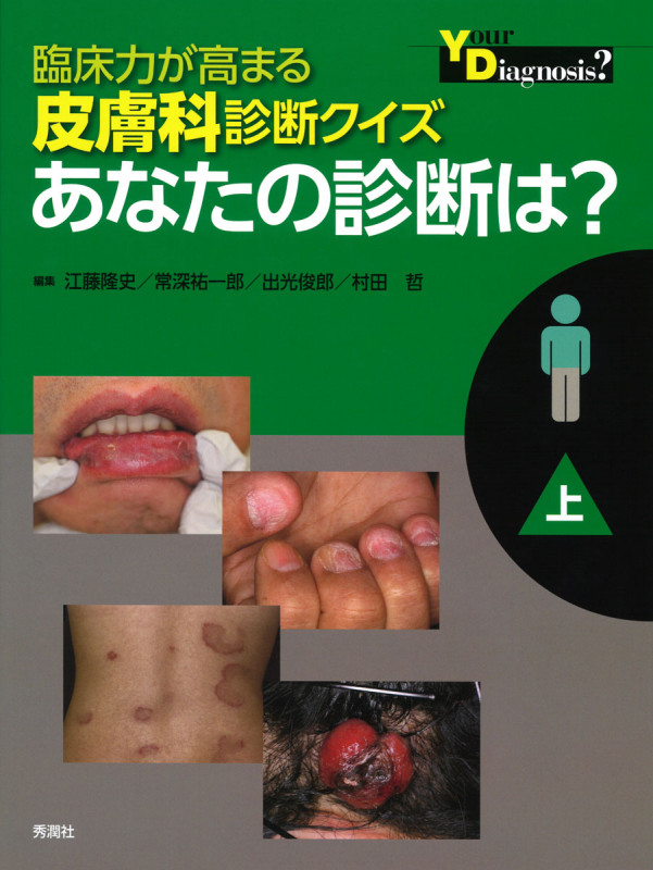 臨床力が高まる皮膚科診断クイズ 上 あなたの診断は?