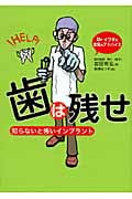 歯は残せ 知らないと怖いインプラント (Dr.イワタの本気のアドバイス)
