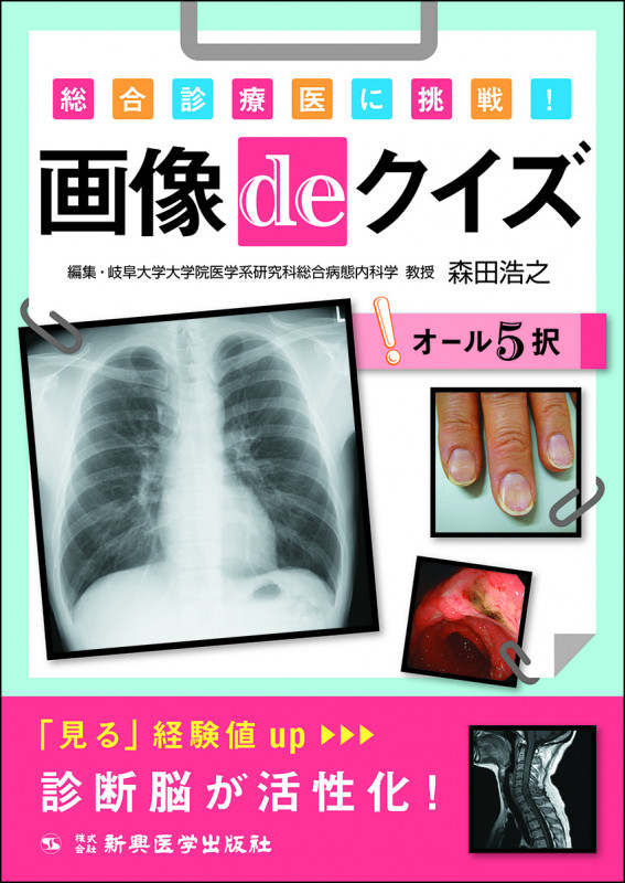 総合診療医に挑戦! 画像deクイズ 総合診療医に挑戦!