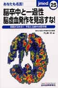 あなたも名医!脳卒中と一過性脳虚血発作を見逃すな! 時間が決め手!予防と治療の水際作戦 (jmed mook 25)