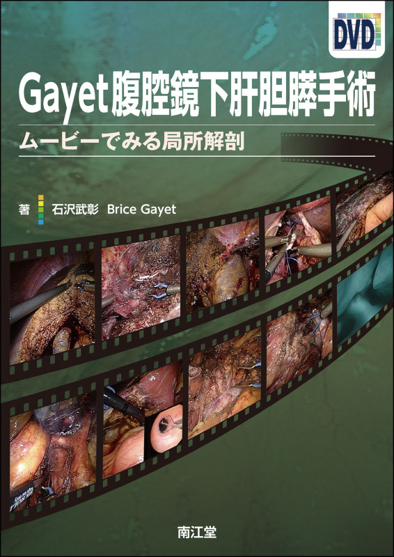 Gayet腹腔鏡下肝胆膵手術 ムービーでみる局所解剖